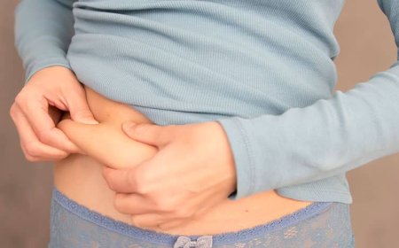 The Ultimate Transformation Life-Changing Effects of Liposuction Surgery in Dubai