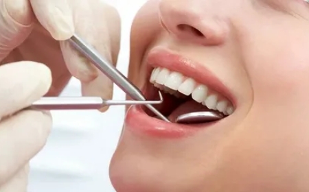 Dental Tooth Filling Dubai: Restore Your Smile with Precision