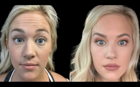 Expert Tips from the Best Doctors in dubai for First-Time Botox Users