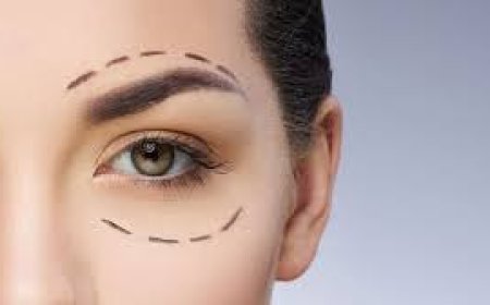 Upper Blephroplasty in Jeddah: Rejuvenate Tired Eyes with Expert Precision