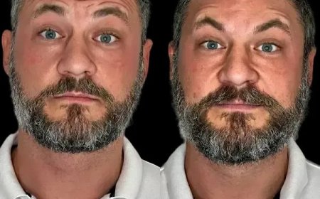 Define Your Skin with Profhilo from Best Plastic Surgeons in dubai