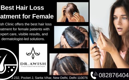 Best Hair Loss Treatment for Female Top Dermatologist Recommended Solutions in 2025