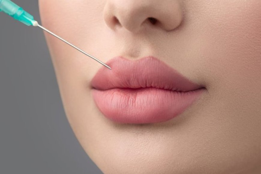 Best Doctors in Dubai Share the Latest Innovations in Russian Lip Fillers