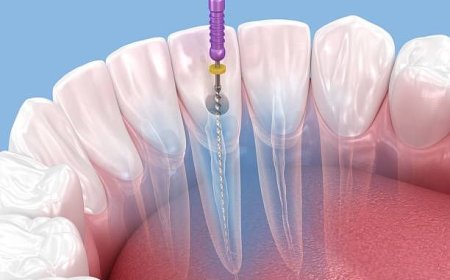 Een Mooie Glimlach Begint bij de Juiste Tandarts in Breda