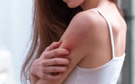 Common Skin Infections and How to Treat Them Effectively