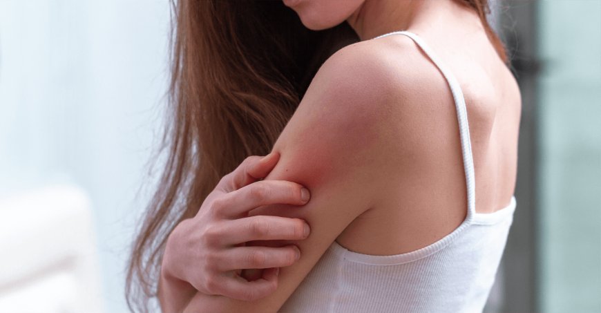 Common Skin Infections and How to Treat Them Effectively